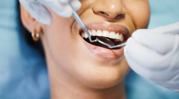 Best Emergency Wisdom Tooth Extraction in North Wales, PA